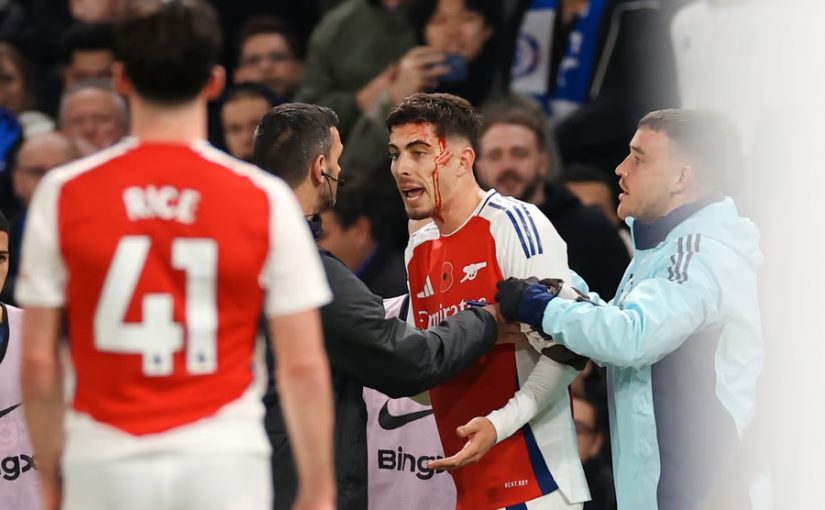 Arsenals dubbelsmäll: Poängtapp och stjärnan ut skadad